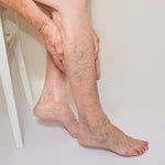 VARICOSE VEINS ORIGINAL™| Crema Para Las Venas Varices
